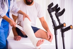 Was darf man mit Gips? Autofahren ist nicht grundsätzlich verboten.